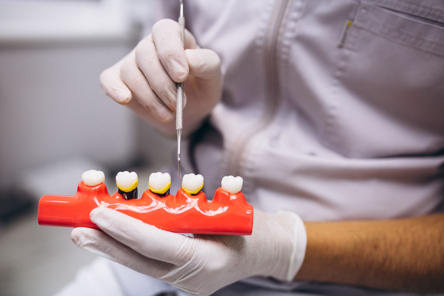 Dental Crown Care Tips for a Longer Lasting Smile
