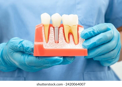 can you get dental implants with bone loss