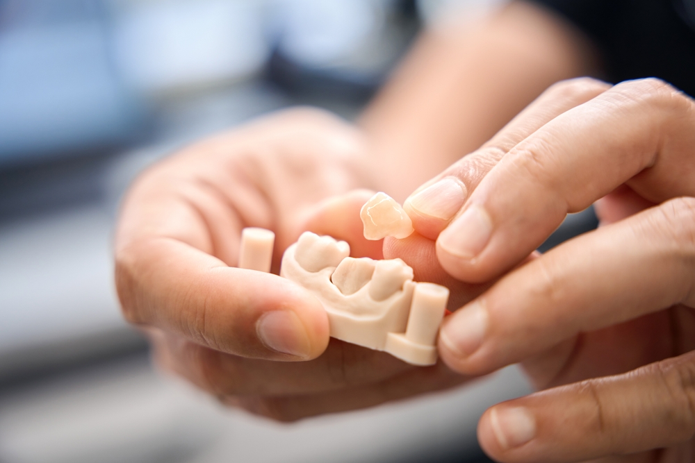 dental crown care tips for a longer lasting smile