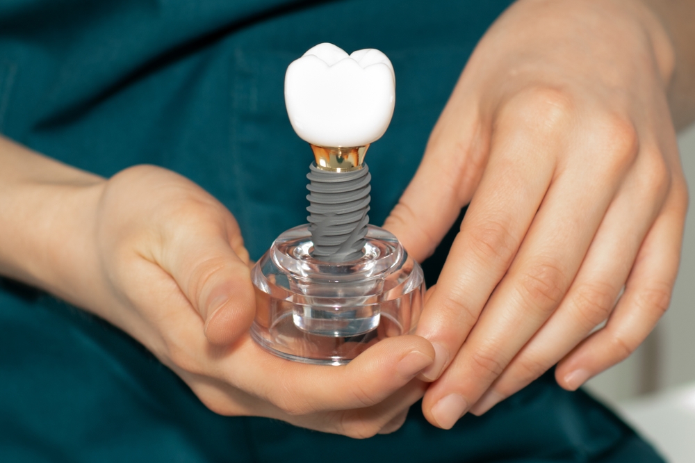 how to take care of your dental implants