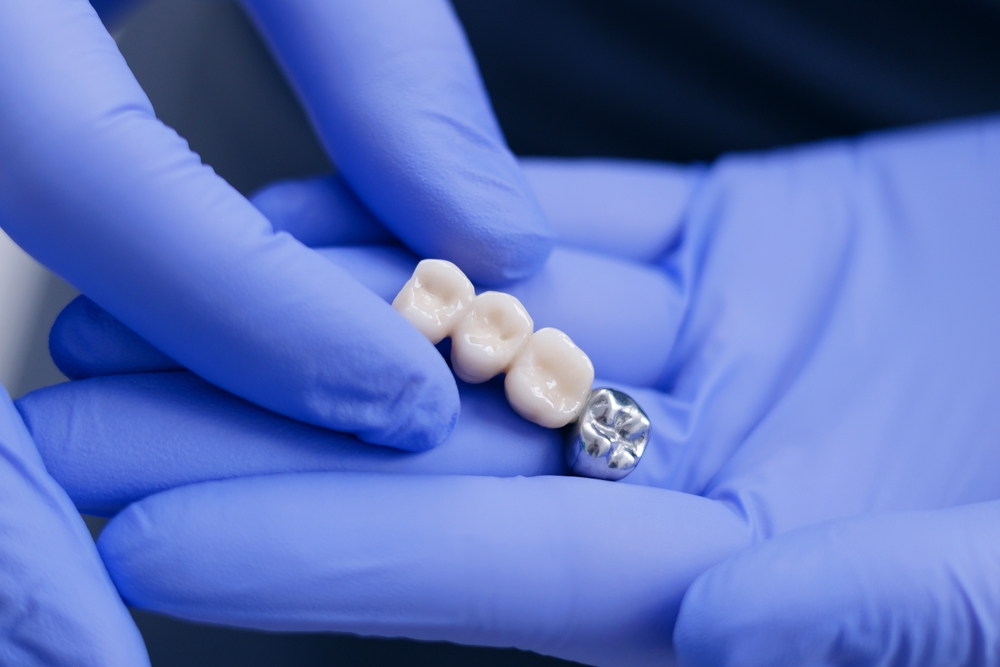 signs you might need a dental bridge soon