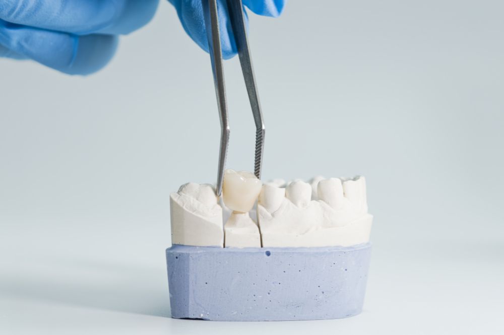 dental crowns
